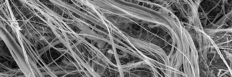  Smaltimento Bonifica Amianto Eternit - SM Ecologica Roma