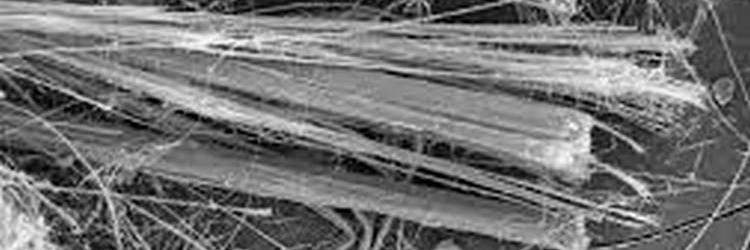  Smaltimento Bonifica Amianto Eternit - SM Ecologica Roma